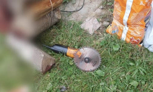 В Новоорске мужчина получил травму болгаркой фото: newgrodno.by