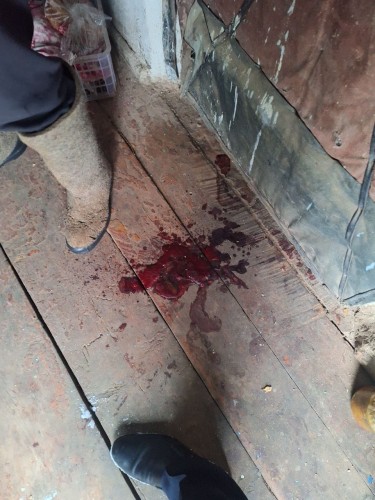 Обвиняемый в нанесении вреда здоровью предстанет перед судом