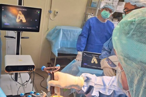 Оренбургская областная клиническая больница им. В.И. Войнова внедряет роботизированную хирургию в травматологии-ортопедии