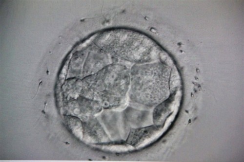 В Оренбургской области за год благодаря процедуре ЭКО родилось 312 малышей