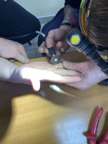 За последний месяц спасатели трижды освобождали оренбуржцев от колец на пальцах